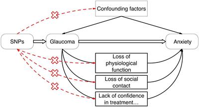 A study exploring the causal relationship between glaucoma and anxiety disorders